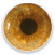 trasplante_de_cornea